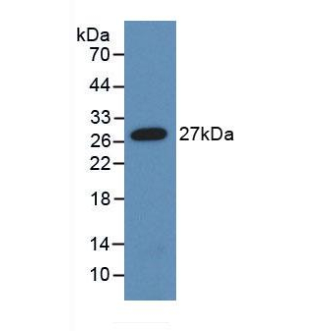 Angiopoietin-3 (ANG-3) Human Monoclonal Antibody