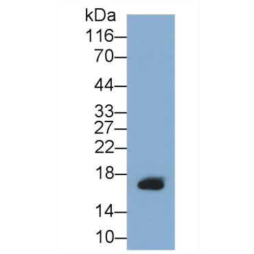 Gastric Inhibitory Polypeptide (GIP) Human Monoclonal Antibody