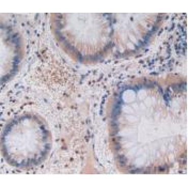 Gastric Inhibitory Polypeptide (GIP) Human Monoclonal Antibody