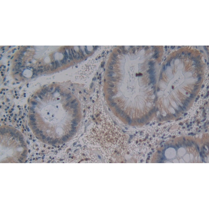 Gastric Inhibitory Polypeptide (GIP) Human Monoclonal Antibody