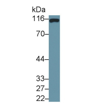Cluster Of Differentiation 26 (CD26) Human Monoclonal Antibody