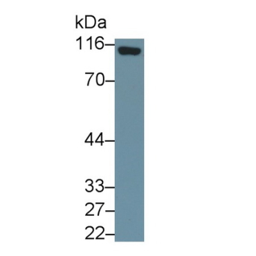 Cluster Of Differentiation 26 (CD26) Human Monoclonal Antibody