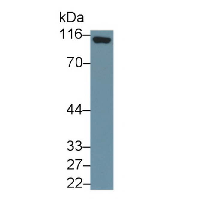 Cluster Of Differentiation 26 (CD26) Human Monoclonal Antibody