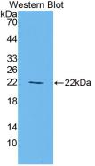 Peroxisome Proliferator Activated Receptor Gamma (PPARg) Rat Monoclonal Antibody
