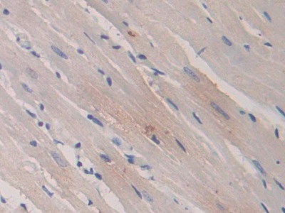 Peroxisome Proliferator Activated Receptor Gamma (PPARg) Rat Monoclonal Antibody