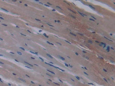 Peroxisome Proliferator Activated Receptor Gamma (PPARg) Rat Monoclonal Antibody