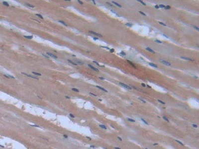 Peroxisome Proliferator Activated Receptor Gamma (PPARg) Rat Monoclonal Antibody