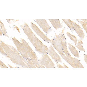 Renin (REN) Human Monoclonal Antibody