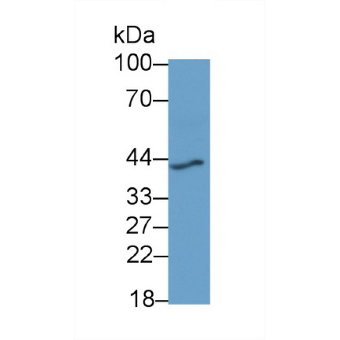Renin (REN) Human Monoclonal Antibody