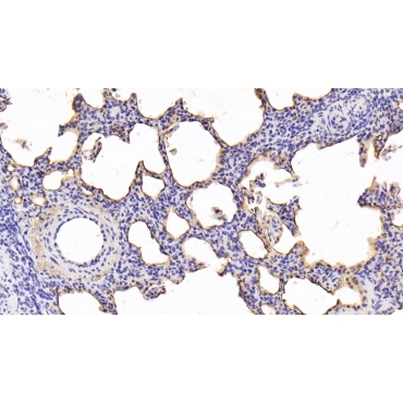Pulmonary Surfactant Associated Protein A1 (SFTPA1) Human Monoclonal Antibody