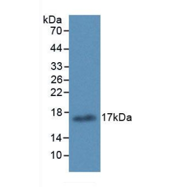 Arachidonate-15-Lipoxygenase (ALOX15) Human Monoclonal Antibody