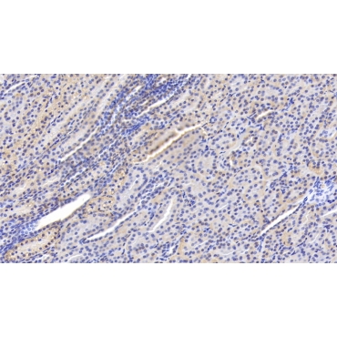 Arachidonate-15-Lipoxygenase (ALOX15) Human Monoclonal Antibody