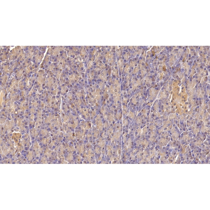 Insulin Receptor (INSR) Human Monoclonal Antibody