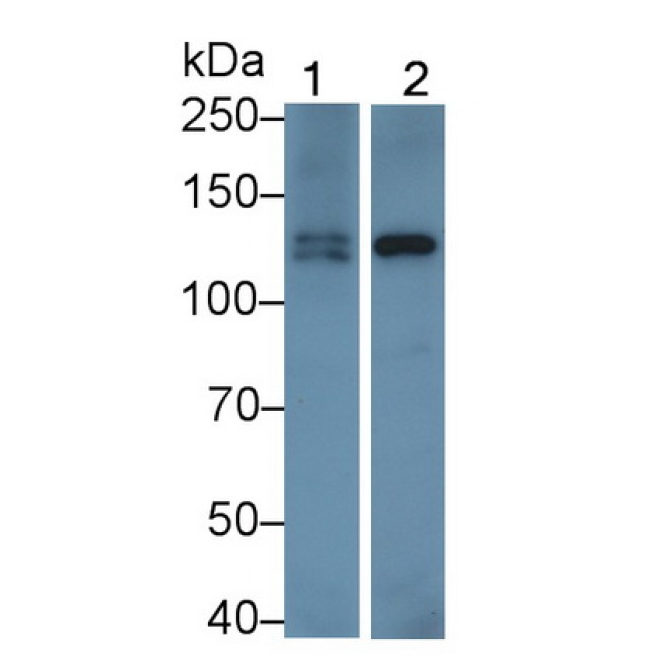 Insulin Receptor (INSR) Human Monoclonal Antibody