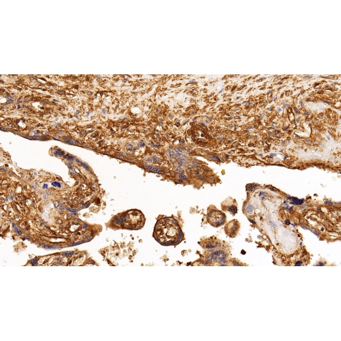 Insulin Receptor (INSR) Human Monoclonal Antibody