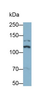 Insulin Receptor (INSR) Rat Monoclonal Antibody