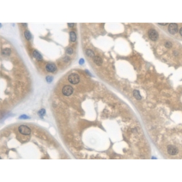 Cystatin C (Cys-C) Human Monoclonal Antibody