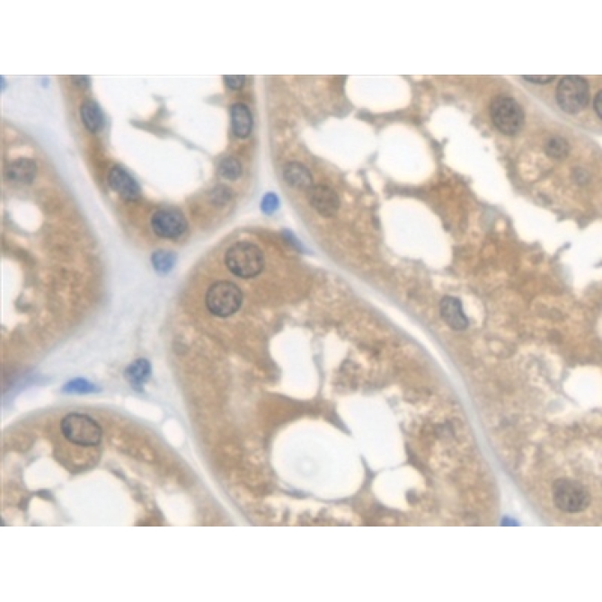 Cystatin C (Cys-C) Human Monoclonal Antibody