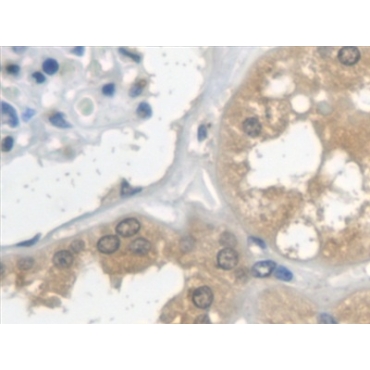 Cystatin C (Cys-C) Human Monoclonal Antibody