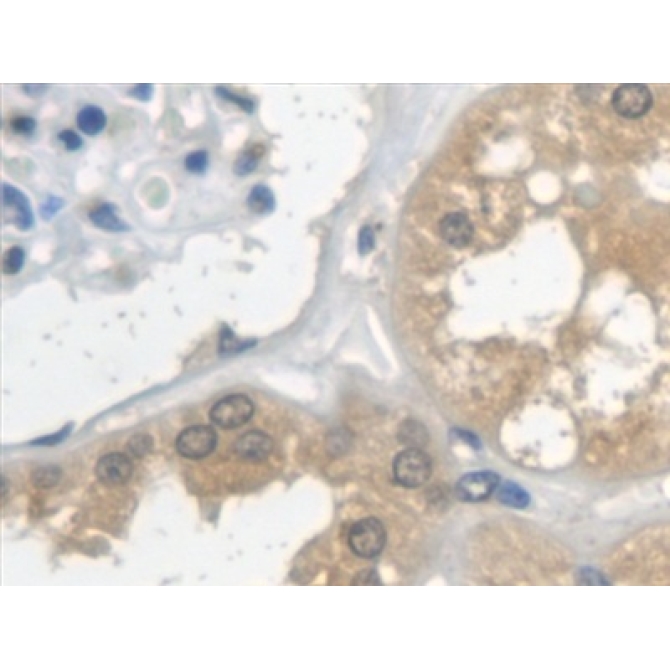 Cystatin C (Cys-C) Human Monoclonal Antibody