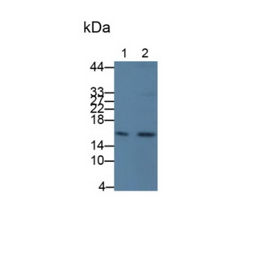 Cystatin C (Cys-C) Human Monoclonal Antibody