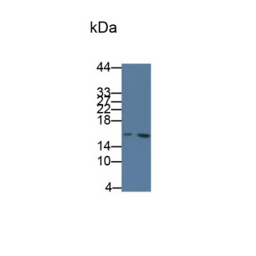 Cystatin C (Cys-C) Human Monoclonal Antibody