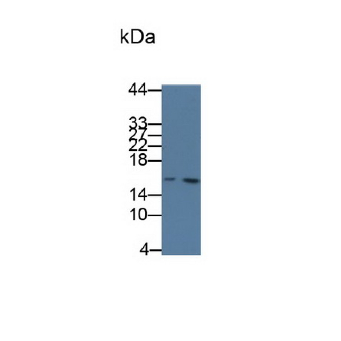 Cystatin C (Cys-C) Human Monoclonal Antibody