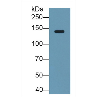 Ceruloplasmin (CP) Human Monoclonal Antibody
