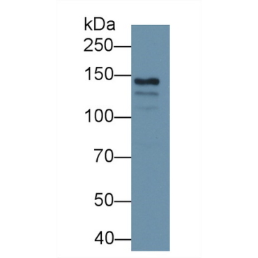 Ceruloplasmin (CP) Human Monoclonal Antibody