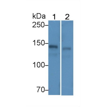Ceruloplasmin (CP) Human Monoclonal Antibody