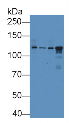 Ceruloplasmin (CP) Rat Monoclonal Antibody