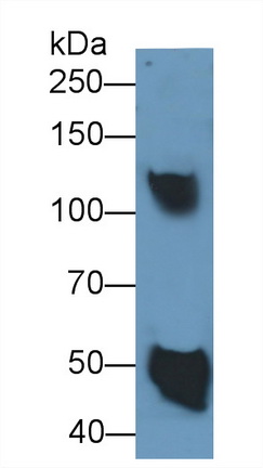 Ceruloplasmin (CP) Rat Monoclonal Antibody