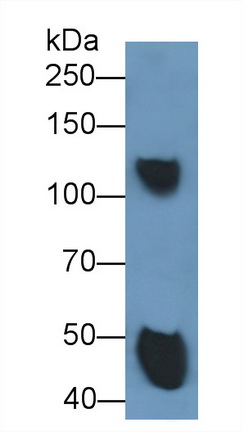 Ceruloplasmin (CP) Rat Monoclonal Antibody