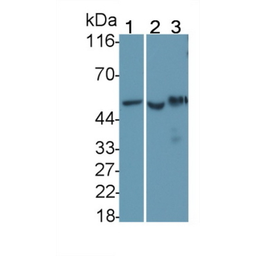 Tumor Protein p53 (P53) Human Monoclonal Antibody