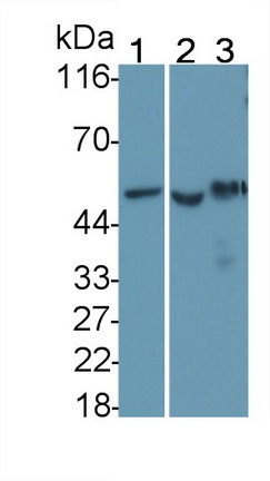 Tumor Protein p53 (P53) Human Monoclonal Antibody