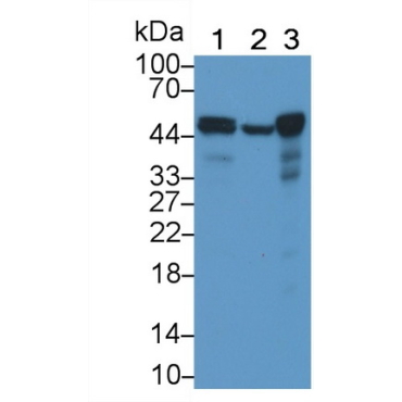 Tumor Protein p53 (P53) Human Monoclonal Antibody