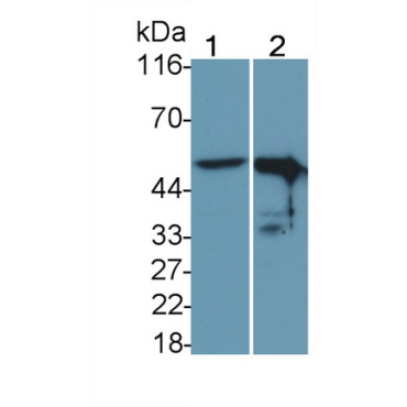 Tumor Protein p53 (P53) Human Monoclonal Antibody