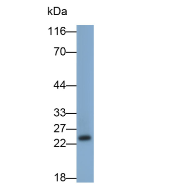 Retinol Binding Protein 4 (RBP4) Human Monoclonal Antibody