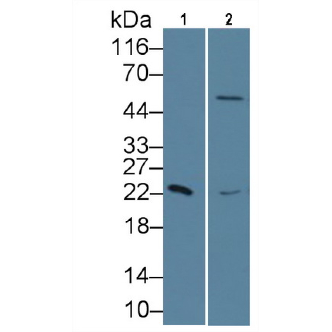 Retinol Binding Protein 4 (RBP4) Human Monoclonal Antibody