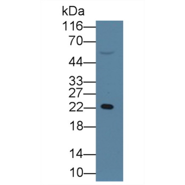 Retinol Binding Protein 4 (RBP4) Human Monoclonal Antibody