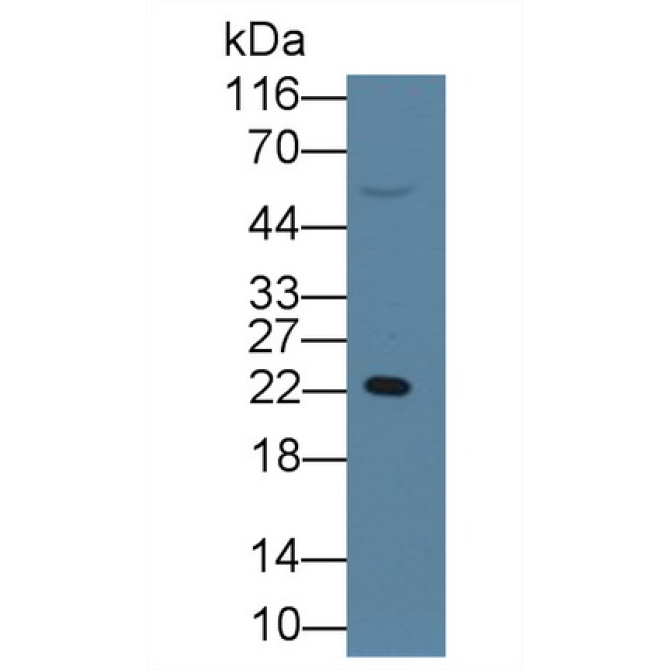 Retinol Binding Protein 4 (RBP4) Human Monoclonal Antibody