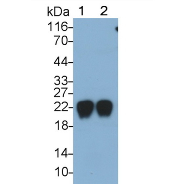 Retinol Binding Protein 4 (RBP4) Human Monoclonal Antibody
