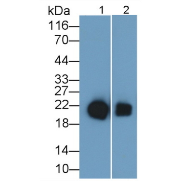 Retinol Binding Protein 4 (RBP4) Human Monoclonal Antibody