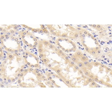 Retinol Binding Protein 4 (RBP4) Human Monoclonal Antibody