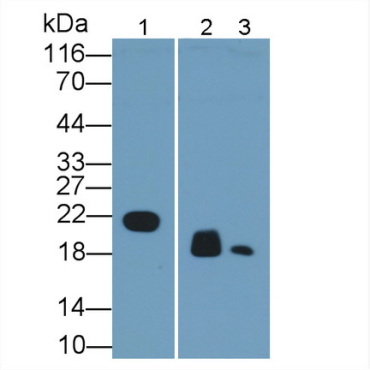 Retinol Binding Protein 4 (RBP4) Human Monoclonal Antibody