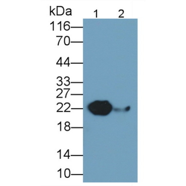Retinol Binding Protein 4 (RBP4) Human Monoclonal Antibody