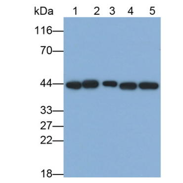 Extracellular Signal Regulated Kinase 2 (ERK2) Human Monoclonal Antibody