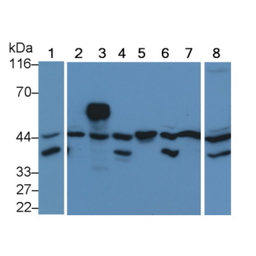 Extracellular Signal Regulated Kinase 2 (ERK2) Human Monoclonal Antibody