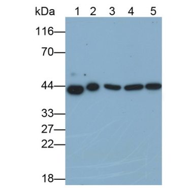 Extracellular Signal Regulated Kinase 2 (ERK2) Human Monoclonal Antibody