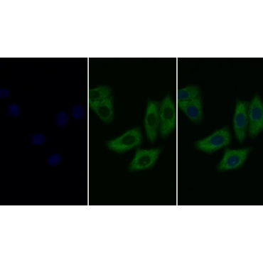 Extracellular Signal Regulated Kinase 2 (ERK2) Human Monoclonal Antibody
